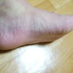 ビブラムファイブフィンガーズを3ヶ月履いて感じた変化